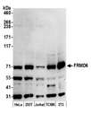 FRMD6 Antibody - Detection of human and mouse FRMD6 by western blot. Samples: Whole cell lysate (15 µg) from HeLa, HEK293T, Jurkat, mouse TCMK-1, and mouse NIH 3T3 cells prepared using NETN lysis buffer. Antibody: Affinity purified rabbit anti-FRMD6 antibody used for WB at 1:1000. Detection: Chemiluminescence with an exposure time of 3 minutes.
