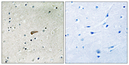 FRS2 Antibody - Immunohistochemistry analysis of paraffin-embedded human brain, using FRS2 (Phospho-Tyr436) Antibody. The picture on the right is blocked with the phospho peptide.