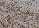 FSBP Antibody - 1:100 staining human spleen tissue by IHC-P. The sample was formaldehyde fixed and a heat mediated antigen retrieval step in citrate buffer was performed. The sample was then blocked and incubated with the antibody for 1.5 hours at 22°C. An HRP conjugated goat anti-rabbit antibody was used as the secondary.