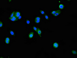 FSIP2 Antibody - Immunofluorescent analysis of HepG2 cells using FSIP2 Antibody at dilution of 1:100 and Alexa Fluor 488-congugated AffiniPure Goat Anti-Rabbit IgG(H+L)