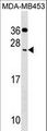FSP27 / CIDEC Antibody - CIDEC Antibody western blot of MDA-MB453 cell line lysates (35 ug/lane). The CIDEC antibody detected the CIDEC protein (arrow).