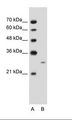 FST / Follistatin Antibody - A: Marker, B: Jurkat Cell Lysate.  This image was taken for the unconjugated form of this product. Other forms have not been tested.