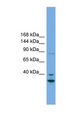 FSTL5 Antibody - FSTL5 antibody Western blot of Fetal Heart lysate. This image was taken for the unconjugated form of this product. Other forms have not been tested.