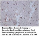 FTH1 / Ferritin Heavy Chain Antibody