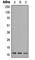 FUNDC1 Antibody - Western blot analysis of FUNDC1 expression in HEK293T (A); NS-1 (B); PC12 (C) whole cell lysates.