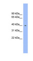 FUT1 / HSC Antibody - FUT1 antibody Western blot of Fetal Heart lysate. This image was taken for the unconjugated form of this product. Other forms have not been tested.