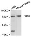 FUT8 Antibody - Western blot analysis of extracts of various cell lines, using FUT8 antibody at 1:3000 dilution. The secondary antibody used was an HRP Goat Anti-Rabbit IgG (H+L) at 1:10000 dilution. Lysates were loaded 25ug per lane and 3% nonfat dry milk in TBST was used for blocking. An ECL Kit was used for detection and the exposure time was 90s.