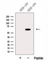 FUT8 Antibody - Western blot analysis of extracts of HEK293 cells using FUT8 antibody. The lane on the left was treated with blocking peptide.