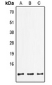 FXYD2 Antibody - Western blot analysis of FXYD2 expression in HepG2 (A); mouse lung (B); rat brain (C) whole cell lysates.