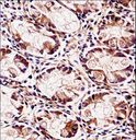 FXYD5 / Dysadherin Antibody - FXYD5 Antibody immunohistochemistry of formalin-fixed and paraffin-embedded human rectum tissue followed by peroxidase-conjugated secondary antibody and DAB staining.