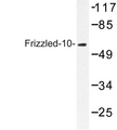 FZD10 / Frizzled 10 Antibody - Western blot of Frizzled-10 (L164) pAb in extracts from COS-7 cells.