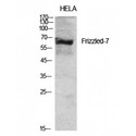 FZD7 / Frizzled 7 Antibody - Western blot of Frizzled-7 antibody