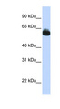 FZD9 / Frizzled 9 Antibody - FZD9 / Frizzled 9 antibody Western blot of Fetal Brain lysate. This image was taken for the unconjugated form of this product. Other forms have not been tested.