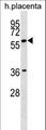 GAB3 Antibody - GAB3 Antibody western blot of human placenta tissue lysates (35 ug/lane). The GAB3 antibody detected the GAB3 protein (arrow).