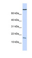 GABARAP Antibody - GABARAP antibody Western blot of 721_B cell lysate. This image was taken for the unconjugated form of this product. Other forms have not been tested.