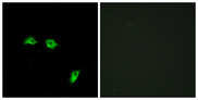 GABBR1 / GABA B Receptor 1 Antibody - Immunofluorescence analysis of HeLa cells, using GABBR1 Antibody. The picture on the right is blocked with the synthesized peptide.