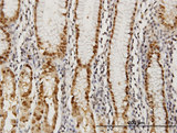 GABPA / NRF2 Antibody - Immunoperoxidase of monoclonal antibody to GABPA on formalin-fixed paraffin-embedded human stomach. [antibody concentration 3 ug/ml]