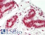 GABPA / NRF2 Antibody - Human Breast: Formalin-Fixed, Paraffin-Embedded (FFPE).  This image was taken for the unconjugated form of this product. Other forms have not been tested.