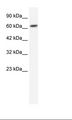 GABRB2 Antibody - Jurkat Cell Lysate.  This image was taken for the unconjugated form of this product. Other forms have not been tested.