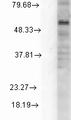 GABRD Antibody - Western blot analysis of GABA(A)R Delta in rat cell line mix using a 1:1000 dilution of GABRD antibody.  This image was taken for the unconjugated form of this product. Other forms have not been tested.
