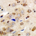 GABRG1 Antibody - Immunohistochemical analysis of GABRG1 staining in human brain formalin fixed paraffin embedded tissue section. The section was pre-treated using heat mediated antigen retrieval with sodium citrate buffer (pH 6.0). The section was then incubated with the antibody at room temperature and detected with HRP and DAB as chromogen. The section was then counterstained with hematoxylin and mounted with DPX.
