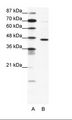 GABRP Antibody - A: Marker, B: Jurkat Cell Lysate.  This image was taken for the unconjugated form of this product. Other forms have not been tested.