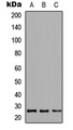 GADD45GIP1 / CRIF1 Antibody - Western blot analysis of CRIF1 expression in HeLa (A); NS-1 (B); PC12 (C) whole cell lysates.