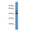 GADL1 Antibody - Western blot of Human HeLa. GADL1 antibody dilution 1.0 ug/ml.  This image was taken for the unconjugated form of this product. Other forms have not been tested.