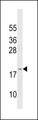 GAGE3 Antibody - GAGE3 Antibody western blot of 293 cell line lysates (35 ug/lane). The GAGE3 Antibody detected the GAGE3 protein (arrow).