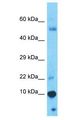 GAGEC1 / JM27 Antibody - GAGEC1 / JM27 antibody Western Blot of Thymus Tumor. Antibody dilution: 1 ug/ml.  This image was taken for the unconjugated form of this product. Other forms have not been tested.
