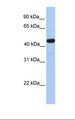 GAL3ST3 Antibody - Fetal liver lysate. Antibody concentration: 1.0 ug/ml. Gel concentration: 12%.  This image was taken for the unconjugated form of this product. Other forms have not been tested.