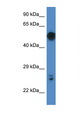 GAL3ST4 Antibody - GAL3ST4 antibody Western blot of Mouse Pancreas lysate. Antibody concentration 1 ug/ml.  This image was taken for the unconjugated form of this product. Other forms have not been tested.