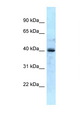 GALK1 / GK1 Antibody - GALK1 antibody Western blot of Fetal Liver lysate. Antibody concentration 1 ug/ml.  This image was taken for the unconjugated form of this product. Other forms have not been tested.