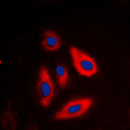 GALK1 / GK1 Antibody - Immunofluorescent analysis of Galactose Kinase staining in HepG2 cells. Formalin-fixed cells were permeabilized with 0.1% Triton X-100 in TBS for 5-10 minutes and blocked with 3% BSA-PBS for 30 minutes at room temperature. Cells were probed with the primary antibody in 3% BSA-PBS and incubated overnight at 4 C in a humidified chamber. Cells were washed with PBST and incubated with a DyLight 594-conjugated secondary antibody (red) in PBS at room temperature in the dark. DAPI was used to stain the cell nuclei (blue).