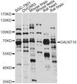 GALNT10 Antibody - Western blot analysis of extracts of various cell lines, using GALNT10 antibody at 1:1000 dilution. The secondary antibody used was an HRP Goat Anti-Rabbit IgG (H+L) at 1:10000 dilution. Lysates were loaded 25ug per lane and 3% nonfat dry milk in TBST was used for blocking. An ECL Kit was used for detection and the exposure time was 60s.