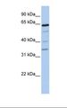 GALNT16 / GALNTL1 Antibody - 721_B cell lysate. Antibody concentration: 1.0 ug/ml. Gel concentration: 12%.  This image was taken for the unconjugated form of this product. Other forms have not been tested.