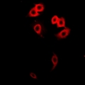 GALNT2 Antibody - Immunofluorescent analysis of GalNAc-T2 staining in HeLa cells. Formalin-fixed cells were permeabilized with 0.1% Triton X-100 in TBS for 5-10 minutes and blocked with 3% BSA-PBS for 30 minutes at room temperature. Cells were probed with the primary antibody in 3% BSA-PBS and incubated overnight at 4 deg C in a humidified chamber. Cells were washed with PBST and incubated with a DyLight 594-conjugated secondary antibody (red) in PBS at room temperature in the dark.