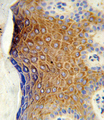 GALNT3 Antibody - Formalin-fixed and paraffin-embedded human skin tissue reacted with GALNT3 Antibody , which was peroxidase-conjugated to the secondary antibody, followed by DAB staining. This data demonstrates the use of this antibody for immunohistochemistry; clinical relevance has not been evaluated.