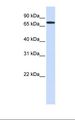 GALNT6 Antibody - 293T cell lysate. Antibody concentration: 1.0 ug/ml. Gel concentration: 12%.  This image was taken for the unconjugated form of this product. Other forms have not been tested.