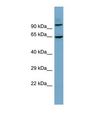 GALNTL6 Antibody - Western blot of Human THP-1. GALNTL6 antibody dilution 1.0 ug/ml.  This image was taken for the unconjugated form of this product. Other forms have not been tested.