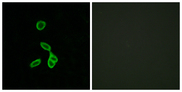 GALR1 / Galanin Receptor 1 Antibody - Immunofluorescence analysis of LOVO cells, using GALR1 Antibody. The picture on the right is blocked with the synthesized peptide.