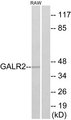 GALR2 / Galanin Receptor 2 Antibody - Western blot analysis of lysates from RAW264.7 cells, using GALR2 Antibody. The lane on the right is blocked with the synthesized peptide.