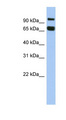 Gametogenetin / GGN Antibody - GGN antibody Western blot of OVCAR-3 cell lysate. This image was taken for the unconjugated form of this product. Other forms have not been tested.