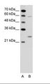 GAMT Antibody - A: Marker, B: Jurkat Cell Lysate.  This image was taken for the unconjugated form of this product. Other forms have not been tested.