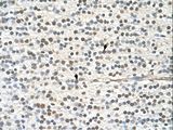 GAPVD1 Antibody - GAPVD1 antibody GAPVD1(GTPase activating protein and VPS9 domains 1) Antibody was used in IHC to stain formalin-fixed, paraffin-embedded human brain.  This image was taken for the unconjugated form of this product. Other forms have not been tested.