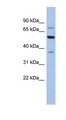 GARS / Glycyl tRNA Synthetase Antibody - GARS antibody Western blot of MCF7 cell lysate. This image was taken for the unconjugated form of this product. Other forms have not been tested.