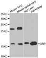 Gastrin Releasing Peptide Antibody - Western blot analysis of extracts of various tissues, using GRP antibody.
