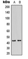 GATA1 Antibody - Western blot analysis of GATA1 (pS310) expression in HeLa (A); HEK293T (B) whole cell lysates.