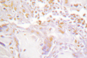 GATA2/3 Antibody - IHC of GATA2/3 (K304) pAb in paraffin-embedded human placenta tissue.