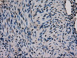 GATA4 Antibody - IHC of paraffin-embedded Human endometrium tissue using anti-GATA4 mouse monoclonal antibody.